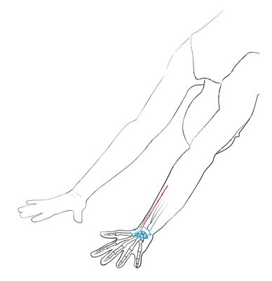 In Körperhaltungen, in denen sich das Handgelenk annähernd in Neutralstellung oder wie hier im herabschauenden Hund in minimaler
Extension befindet, sollten Kleinfinger- und Daumenkante gleichmäßig verwurzelt sein.
